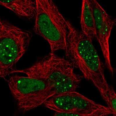 Immunocytochemistry/ Immunofluorescence: Bcl-9 Antibody [NBP2-30472]