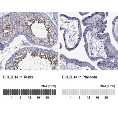 Immunocytochemistry/ Immunofluorescence: Bcl G Antibody [NBP3-17024]