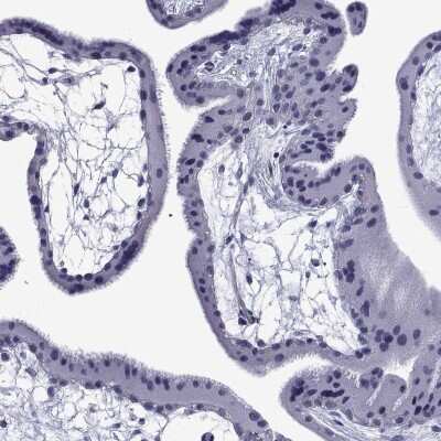 Immunohistochemistry-Paraffin: Bcl G Antibody [NBP3-17024]