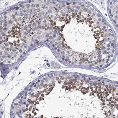 Immunohistochemistry-Paraffin: Bcl G Antibody [NBP3-17024]