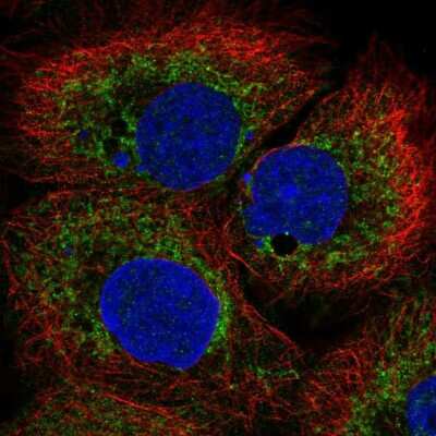 Immunocytochemistry/ Immunofluorescence: Bcl rambo Antibody [NBP1-90002]