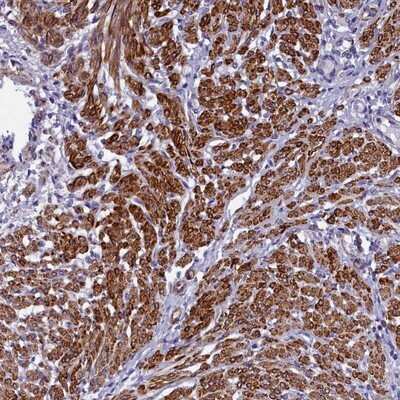 Immunohistochemistry-Paraffin: Bcl rambo Antibody [NBP1-90002]