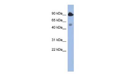 Western Blot: Bcl rambo Antibody [NBP3-10870]
