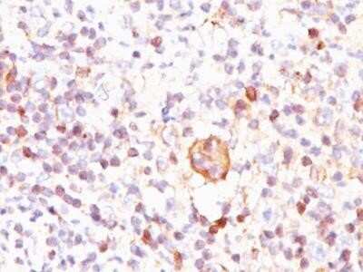 Immunohistochemistry-Paraffin: bcl-x Antibody (BX006) - Azide and BSA Free [NBP2-33164]