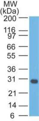 Western Blot: bcl-x Antibody (BX006) [NBP2-25240]