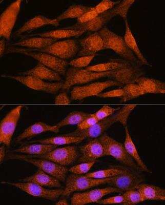 Immunocytochemistry/ Immunofluorescence: Bcl3 Antibody - Azide and BSA Free [NBP2-92041]