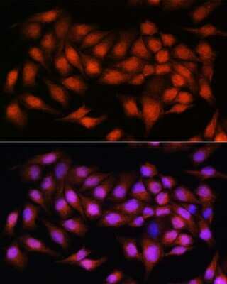 Immunocytochemistry/ Immunofluorescence: Bcl3 Antibody - Azide and BSA Free [NBP2-92041]