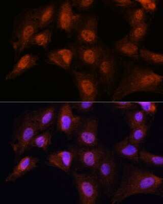 Immunocytochemistry/ Immunofluorescence: Bcl3 Antibody - Azide and BSA Free [NBP2-92041]