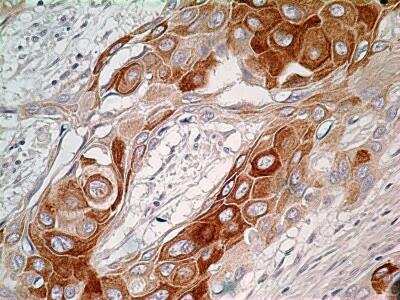 Immunohistochemistry-Paraffin: Bcl-6 Antibody [NBP2-31369]