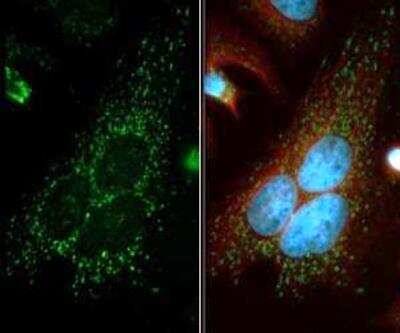 Immunocytochemistry/ Immunofluorescence: Beclin 1 Antibody Pack [NB910-95609]