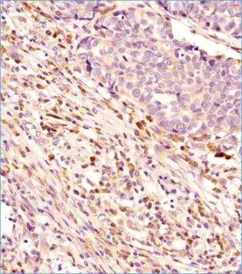 Immunohistochemistry: Beclin 1 Antibody Pack [NB910-95609]