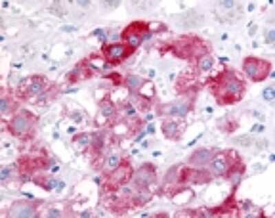 Immunohistochemistry: Beclin 1 Antibody Pack [NB910-95610]