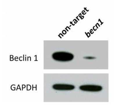 Knockdown Validated: Beclin 1 Antibody Pack [NB910-95609]
