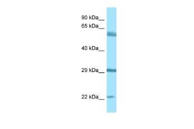 Western Blot: Begain Antibody [NBP2-84502]