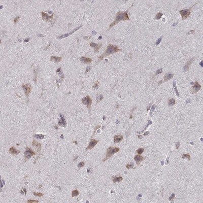 Immunohistochemistry-Paraffin: Bend6 Antibody [NBP1-88811]