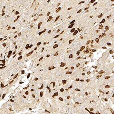 Immunocytochemistry: Bestrophin 1 Antibody (E6-6) - Azide and BSA Free [NBP2-80593]