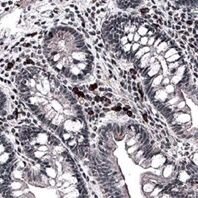 Immunohistochemistry: Bestrophin 1 Antibody (E6-6) - Azide and BSA Free [NBP2-80593]