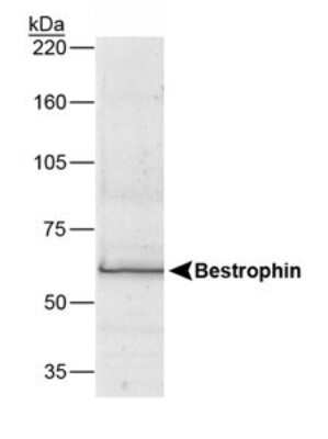 Western Blot: Bestrophin 1 Antibody (E6-6)Azide and BSA Free [NBP2-80593]