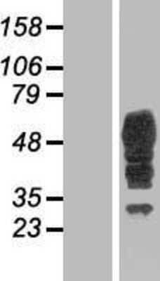 Western Blot: Bestrophin 3 Overexpression Lysate [NBP2-05368]