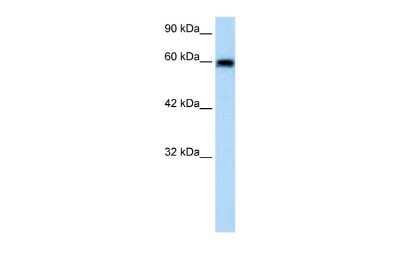 Western Blot: Bestrophin 4 Antibody [NBP2-84504]