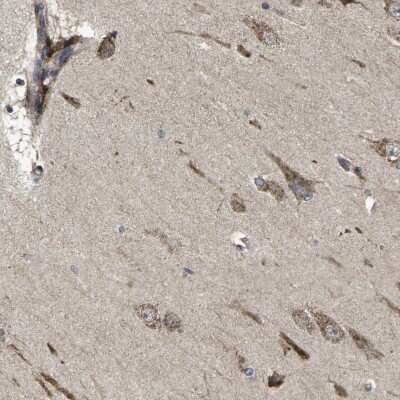Immunohistochemistry-Paraffin: Beta-1,3-N-Acetylglucosaminyltransferase 1/B3GNT1 Antibody [NBP1-88952]