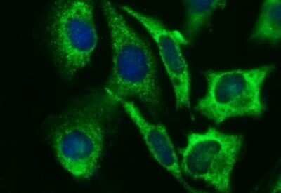 Immunocytochemistry/ Immunofluorescence: Beta-1,3-N-Acetylglucosaminyltransferase 2/B3GNT2 Antibody (OTI3A9) - Azide and BSA Free [NBP2-71624]