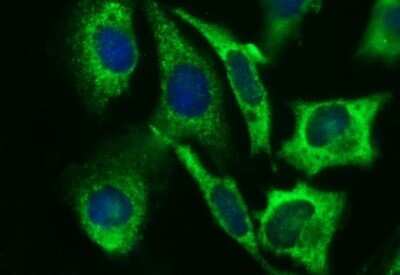 Immunocytochemistry/ Immunofluorescence: Beta-1,3-N-Acetylglucosaminyltransferase 2/B3GNT2 Antibody (OTI3A9) [NBP2-45527]