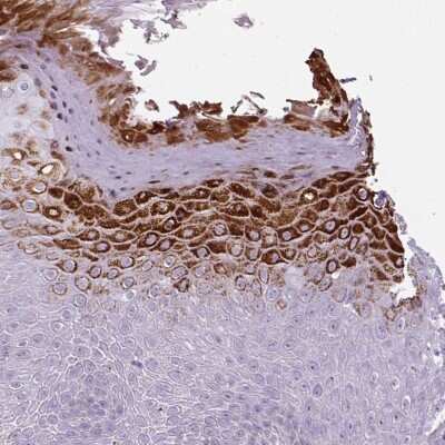 Immunohistochemistry-Paraffin: Beta-1,3-N-Acetylglucosaminyltransferase 4/B3GNT4 Antibody [NBP2-30927]