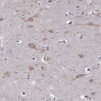 Immunohistochemistry-Paraffin: Beta-1,3-N-Acetylglucosaminyltransferase 6/B3GNT6 Antibody [NBP2-48715]