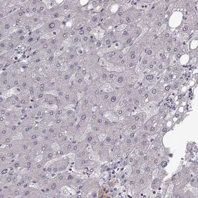 Immunohistochemistry-Paraffin: Beta-1,3-N-Acetylglucosaminyltransferase 6/B3GNT6 Antibody [NBP2-48715]