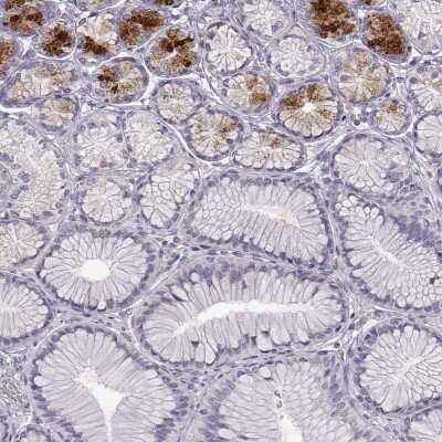 Immunohistochemistry-Paraffin: Beta-1,3-N-Acetylglucosaminyltransferase 6/B3GNT6 Antibody [NBP2-48715]