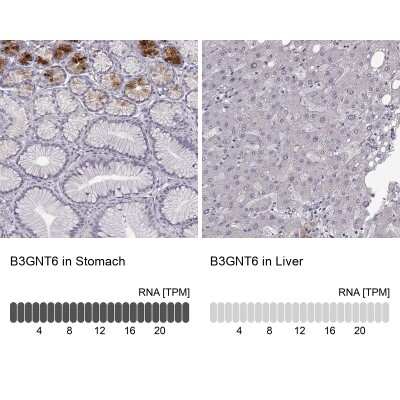 Immunohistochemistry-Paraffin: Beta-1,3-N-Acetylglucosaminyltransferase 6/B3GNT6 Antibody [NBP2-48715]