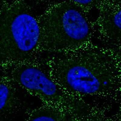 Immunocytochemistry/ Immunofluorescence: Beta 2 Adaptin Antibody [NBP2-58316]