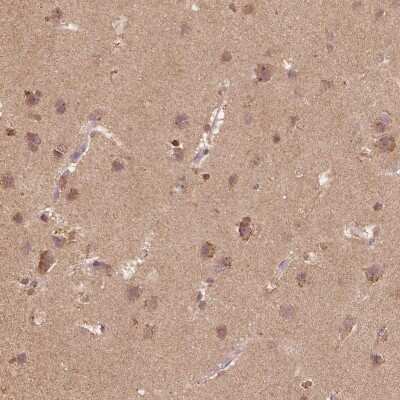 Immunohistochemistry-Paraffin: Beta 2 Adaptin Antibody [NBP2-68864]
