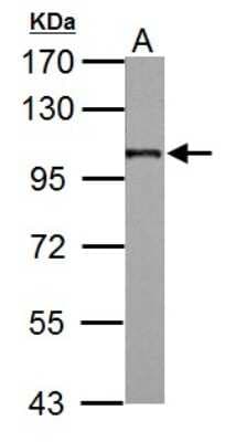 Western Blot: Beta 2 Adaptin Antibody [NBP2-15563]