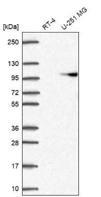 Western Blot: Beta 2 Adaptin Antibody [NBP2-58316]