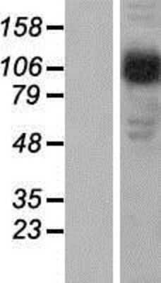 Western Blot: Beta 2 Adaptin Overexpression Lysate [NBP2-11335]