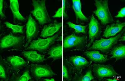 Immunocytochemistry/ Immunofluorescence: Beta Dystroglycan Antibody (GT835) [NBP3-13643]