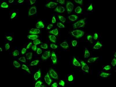 Immunocytochemistry/ Immunofluorescence: Beta Hydroxysteroid Dehydrogenase Antibody - Azide and BSA Free [NBP2-92640]