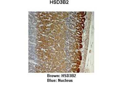 Immunohistochemistry: Beta Hydroxysteroid Dehydrogenase Antibody [NBP1-59531]