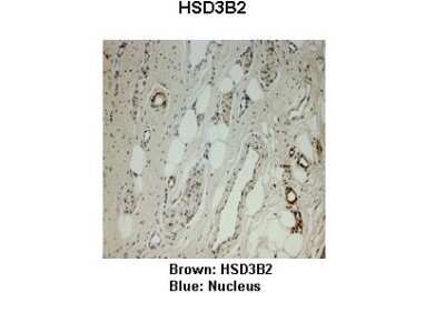 Immunohistochemistry: Beta Hydroxysteroid Dehydrogenase Antibody [NBP1-59531]