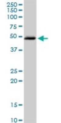 Western Blot: Beta Hydroxysteroid Dehydrogenase Antibody [H00003284-D01P]