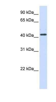 Western Blot: Beta Hydroxysteroid Dehydrogenase Antibody [NBP1-59531]