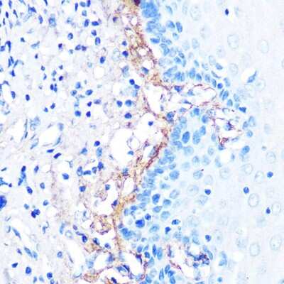 Immunohistochemistry-Paraffin: Beta Ig-h3/TGFBI Antibody (7Q5O9) [NBP3-15994]