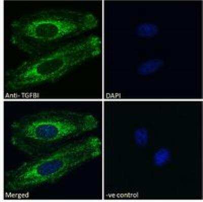 Immunocytochemistry/ Immunofluorescence: Beta Ig-h3/TGFBI Antibody [NBP1-47215]