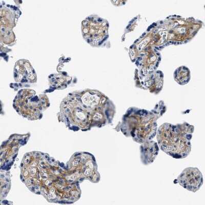 Immunohistochemistry: Beta Ig-h3/TGFBI Antibody [NBP2-48534]