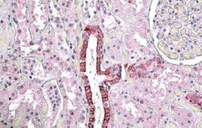 Immunohistochemistry-Paraffin: Beta Ig-h3/TGFBI Antibody [NBP1-47215]