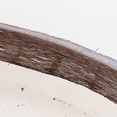 Immunohistochemistry-Paraffin: Beta Ig-h3/TGFBI Antibody [NBP2-48534]