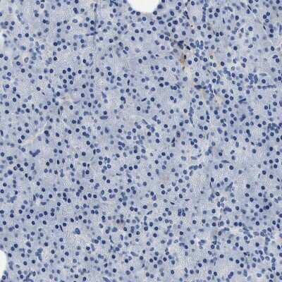 Immunohistochemistry-Paraffin: Beta Ig-h3/TGFBI Antibody [NBP2-48534]