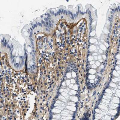 Immunohistochemistry-Paraffin: Beta Ig-h3/TGFBI Antibody [NBP2-48534]